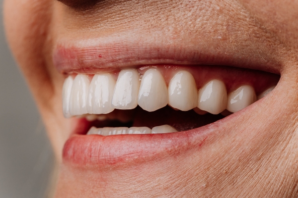 Dental Crowns: More Than A Cosmetic Treatment