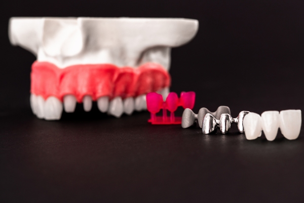 What Are The Differences Between Zirconia And Porcelain Dental Crowns?