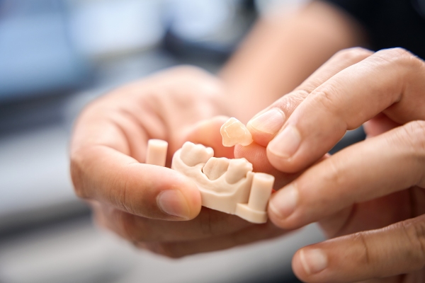Types Of Dental Crowns And Which Material To Choose